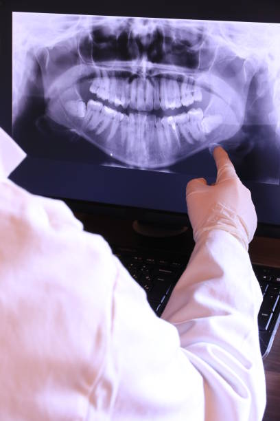 Best Emergency Wisdom Teeth Removal in West Deland, FL