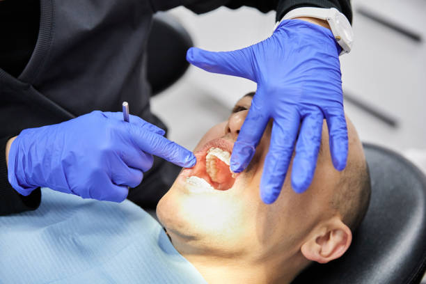 Best Emergency Tooth Extraction in West Deland, FL