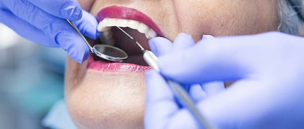Best Emergency Dental Care for Broken or Chipped Teeth in West Deland, FL